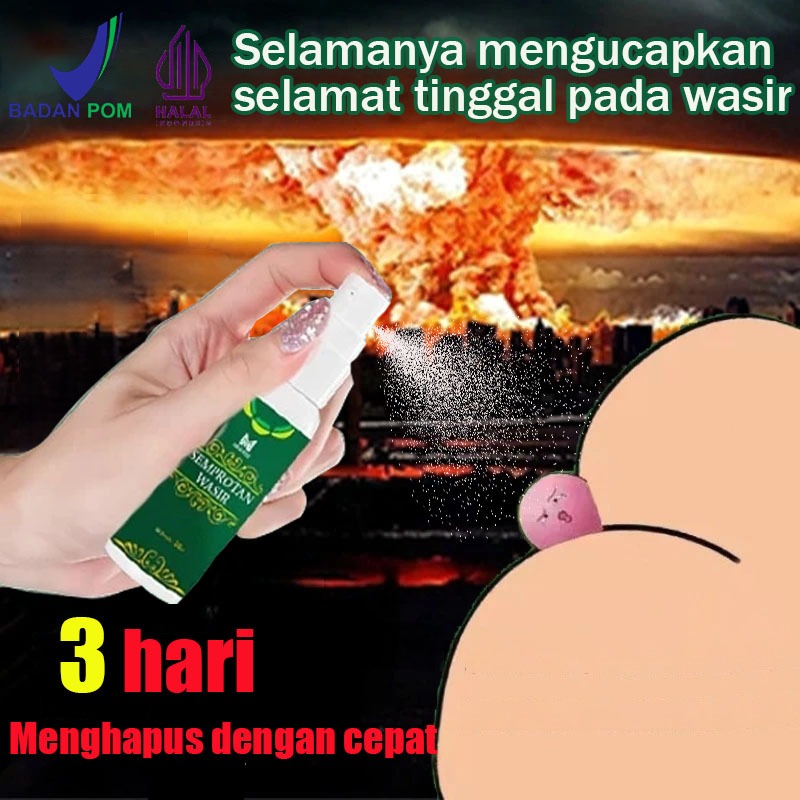 Salep dan semprotan wasir yang efektif untuk mengobati wasir, obat wasir, peradangan anus, wasir eks