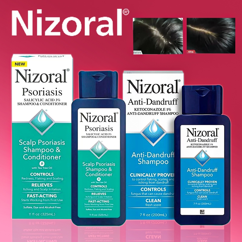 Nizoral A-D Anti-Dandruff Shampoo 200ml / Scalp Psoriasis Shampoo & Conditioner 325ml / Anti-Dandruf