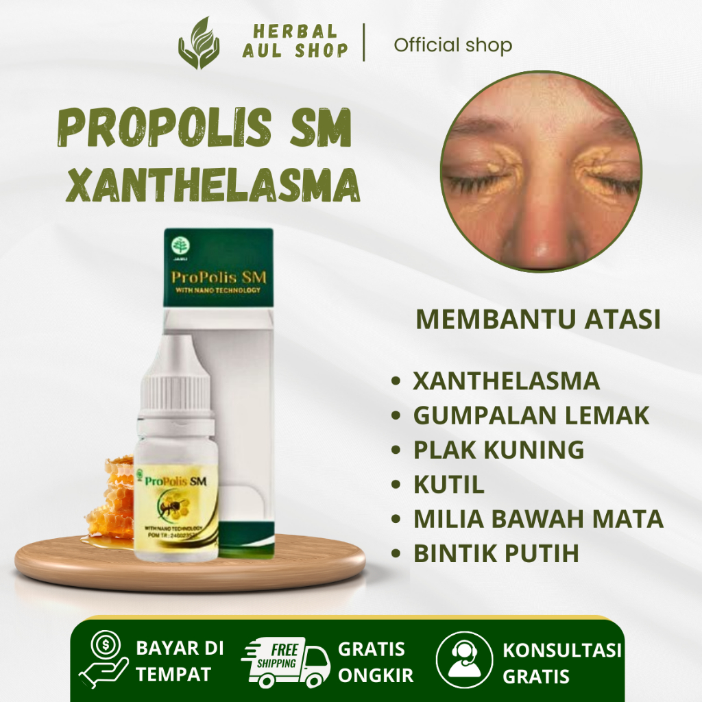 Obat Hebal Xanthelasma, Gumpalan Lemak di Kelopak Mata, Plak Kuning, Kutil Di Kelopak Mata - Isi 6ml