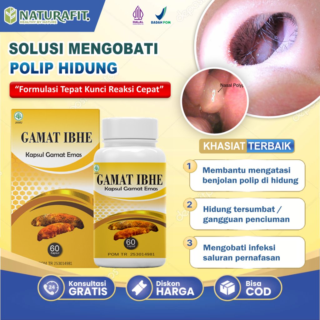 Obat Polip Hidung Paling Ampuh, Sinusitis, Benjolan di Hidung, Infeksi Saluran Pernapasan, Hidung Te