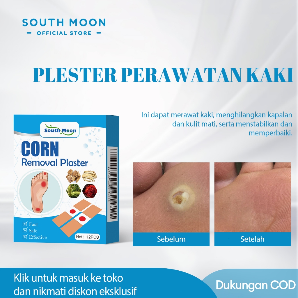 South Moon mata ikan plester 24pcs mata ikan plester menghilangkan kutil Obat Kutil Plester Kutil Am