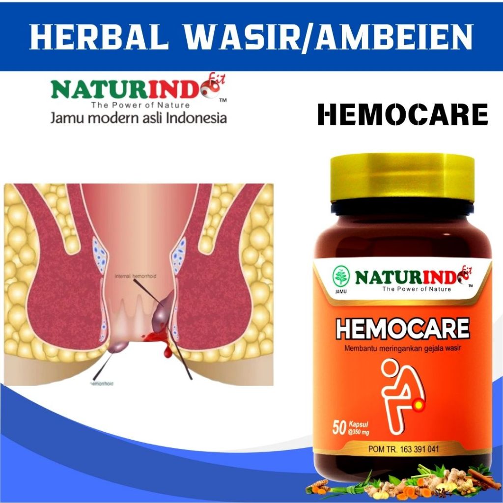 Obat Wasir Stadium 4 benjolan Anus Bab Berdarah