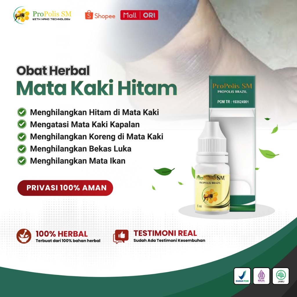 Obat Mata Kaki Hitam, Obat Pemutih Mata Kaki Hitam, Obat Oles Mata Kaki Hitam, Obat Mata Kaki Kering