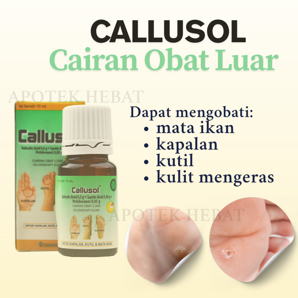 Callusol Obat Kutil Mata Ikan Kapalan Kaki Kulit Kaki Tebal botol 5mL