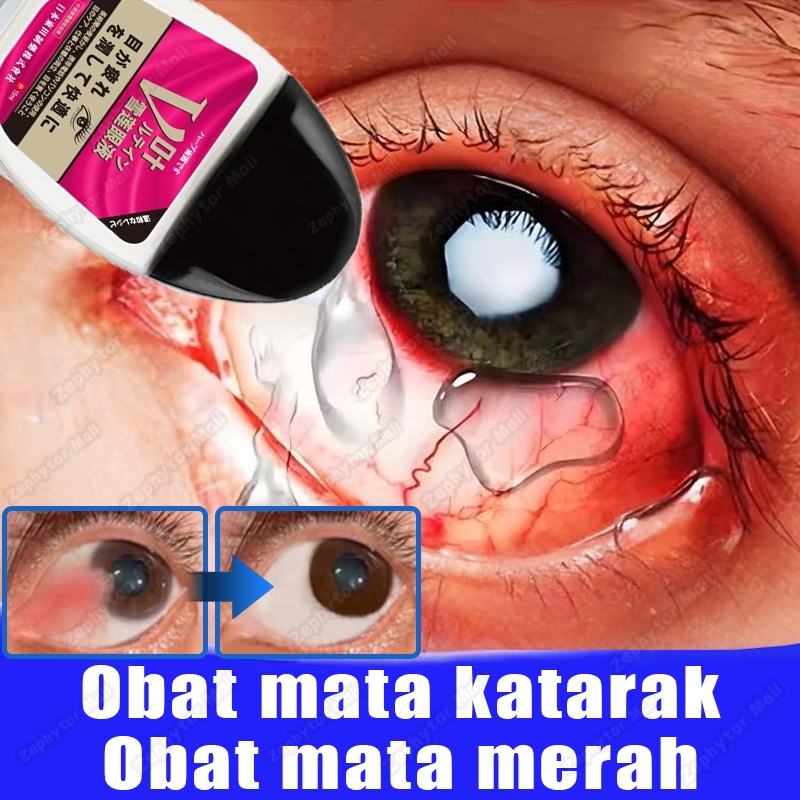tetes mata jepang 15ml obat mata katarak obat sakit mata obat mata minus tetes mata kering/merah/bur