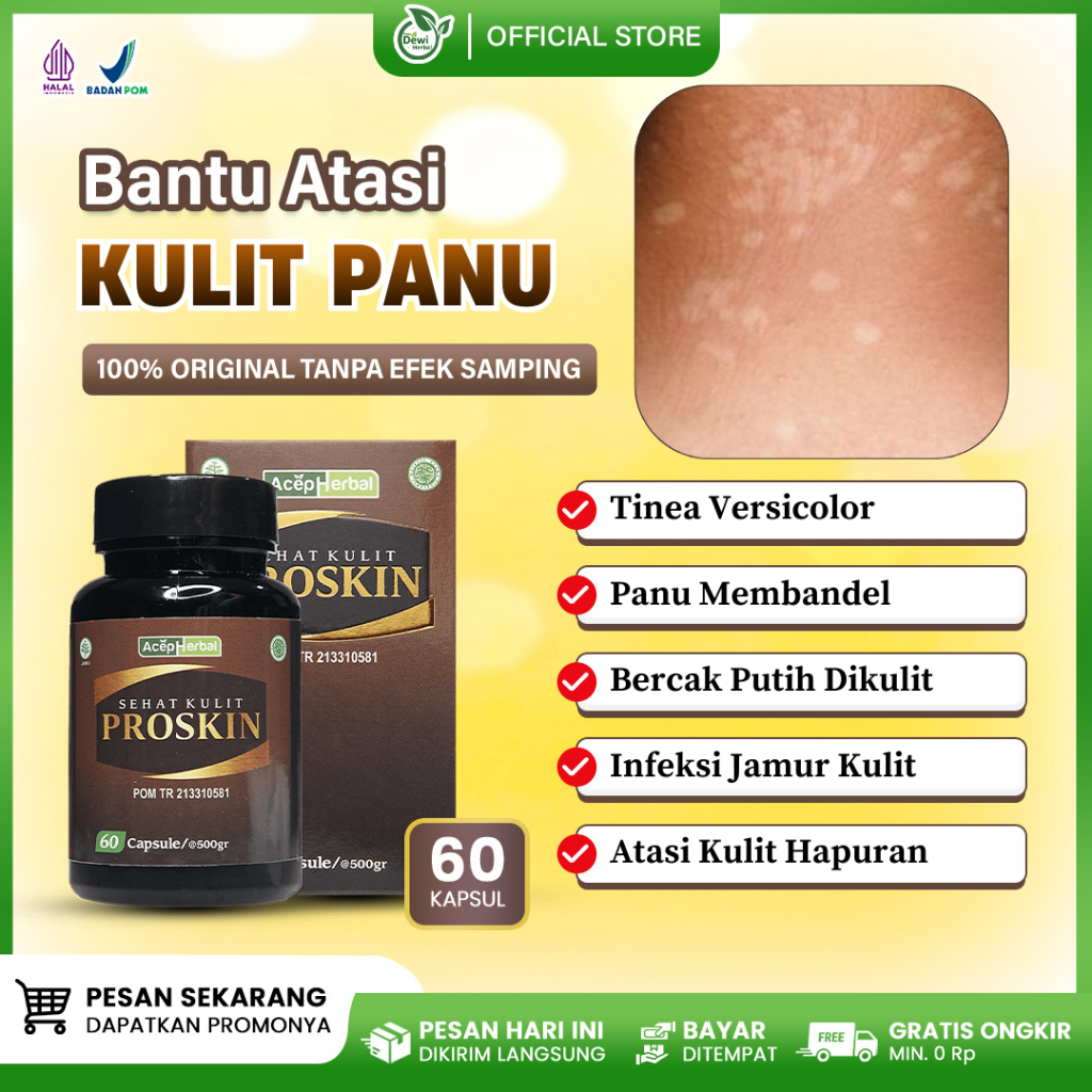 Proskin 60 kapsul - Obat Panu Membandel, Kulit Panuan Di Tangan Wajah Kaki Punggung, Hapuran, Bercak