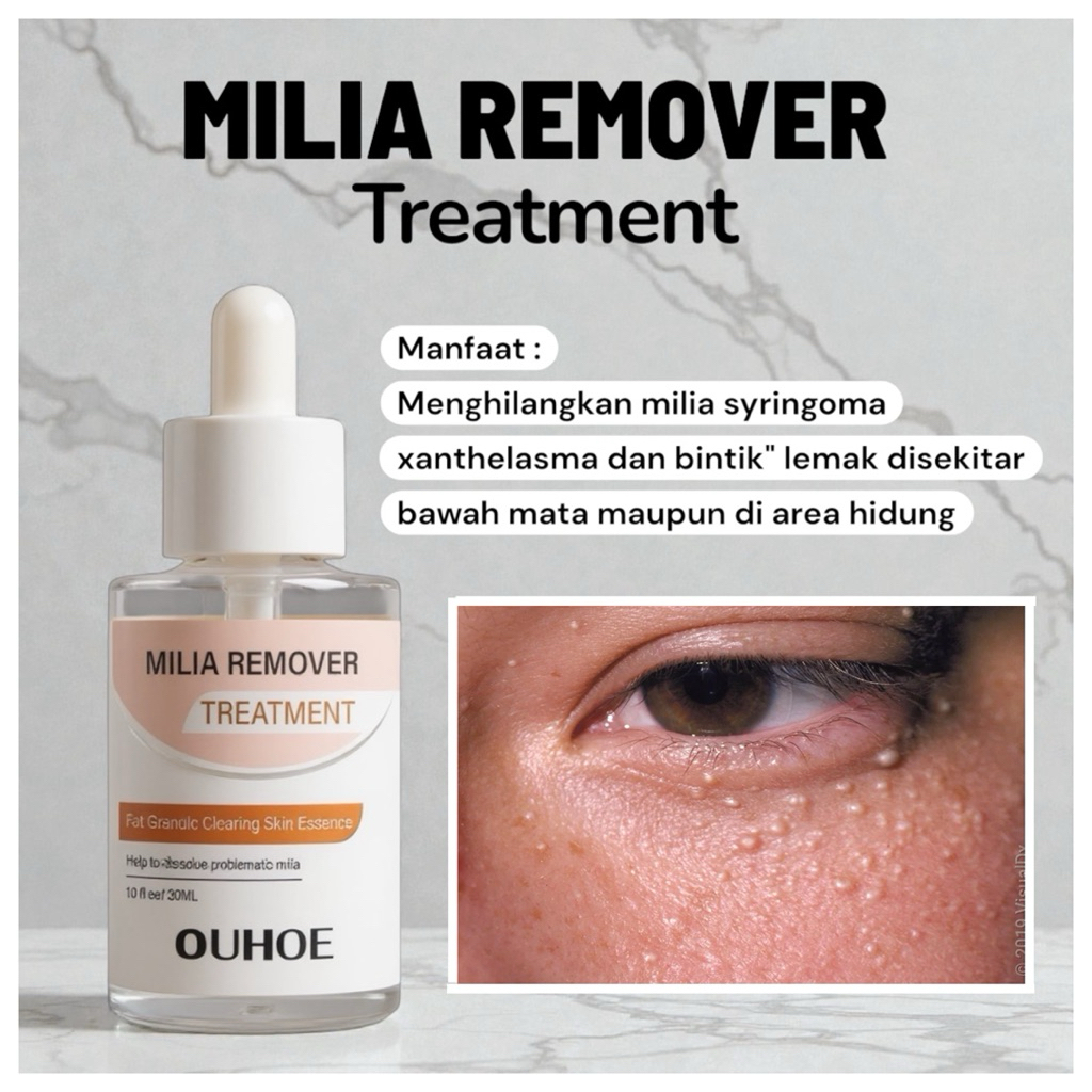 Milia Remover Serum Penghilang Perontok Milia Bintik Putih Mata Ouhoe Milia Remover Treatment Oil-Fr