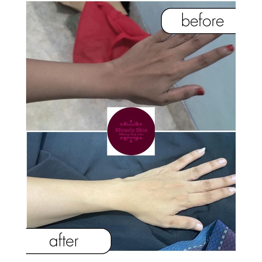 Miracle Skin_ Whitening body Lotion