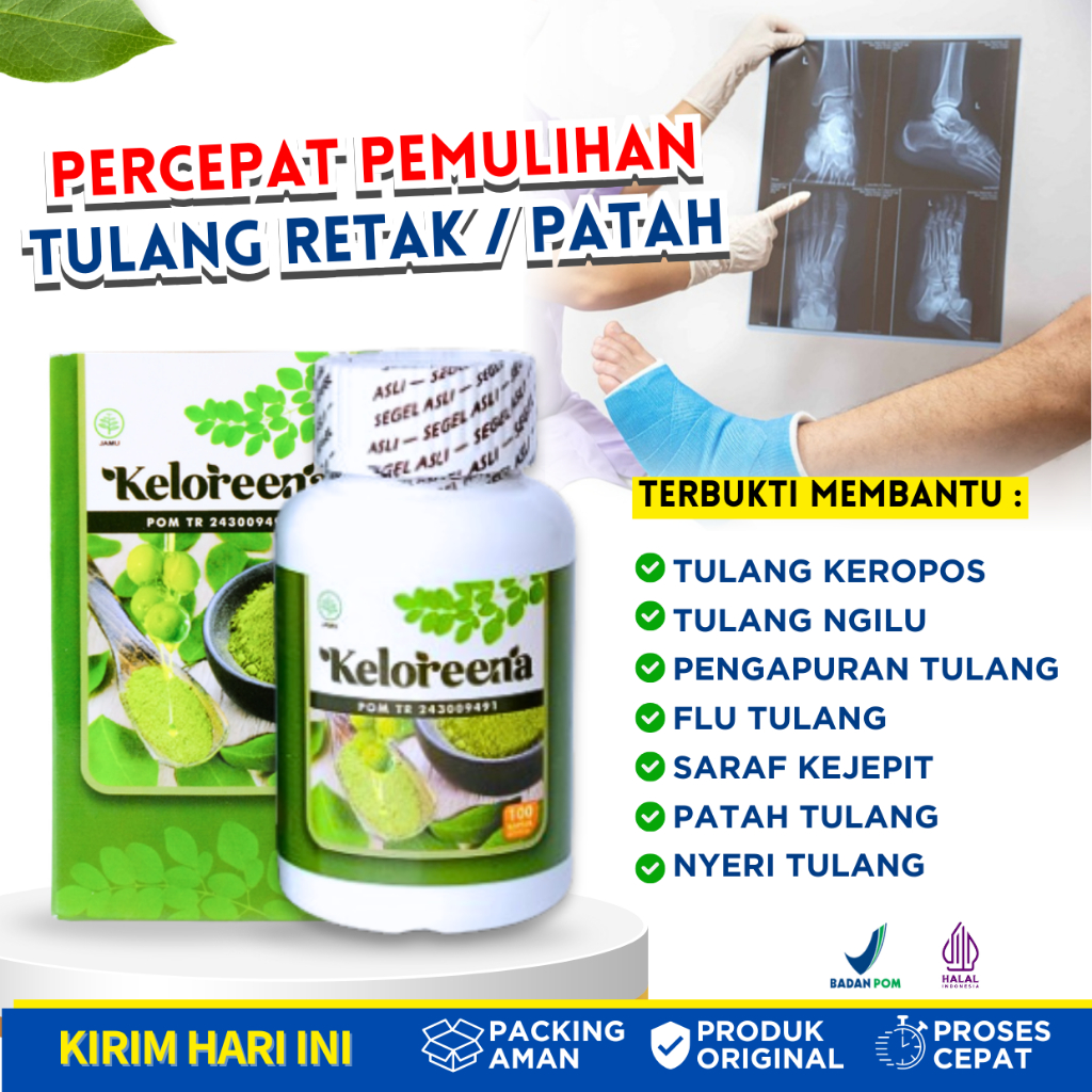 Obat Tulang Retak Patah Tulang Keropos Ngilu Pengapuran Tulang dan Sendi Flu Tulang Nyeri Saraf Keje
