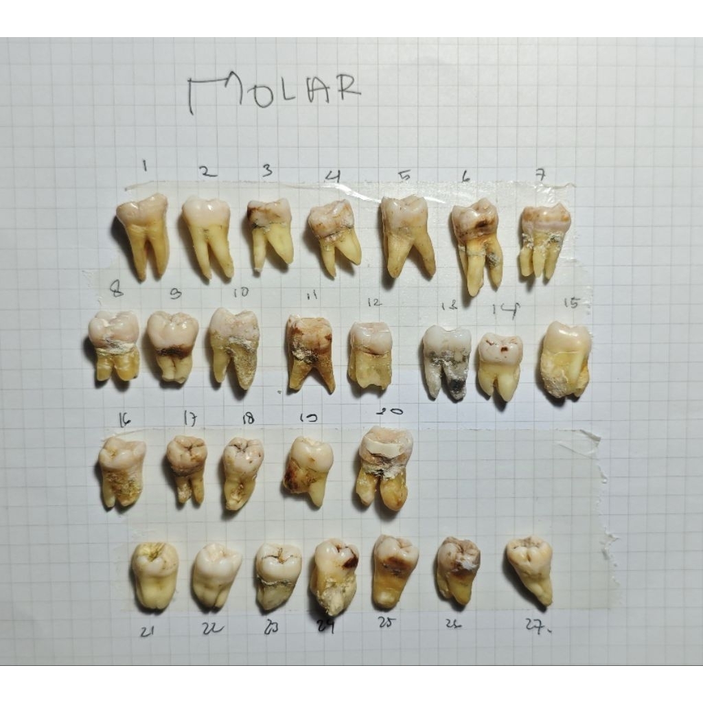 Gigi Asli | Gigi Permanen | Gigi Praktikum | Gigi Molar