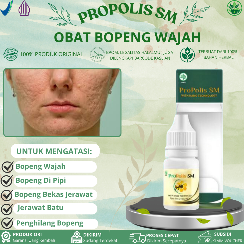 Propolis SM Untuk Bopeng Wajah, Bopeng bekas jerawat, bekas cacar, penghilang bopeng di pipi, bekas 