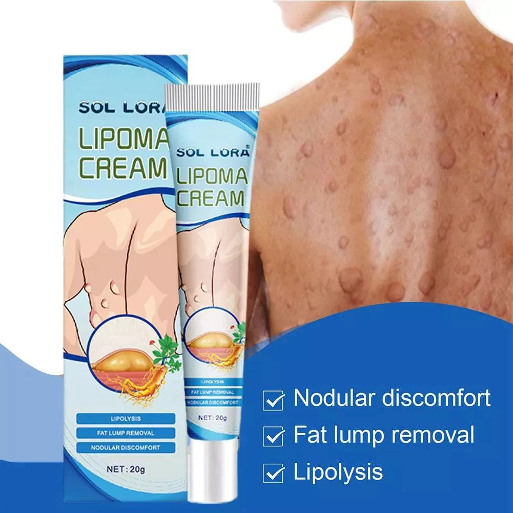 Lipoma Cream Original 20g Salep Lipoma Salep Benjolan Obat Salep Benjolan Lipoma Obat Benjolan Obat 