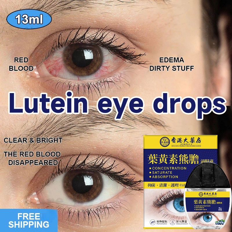 Tetes Mata Lutein Lutein eye drops 15ml Khusus untuk mata kuning dan bercak di mata Baik untuk anak-