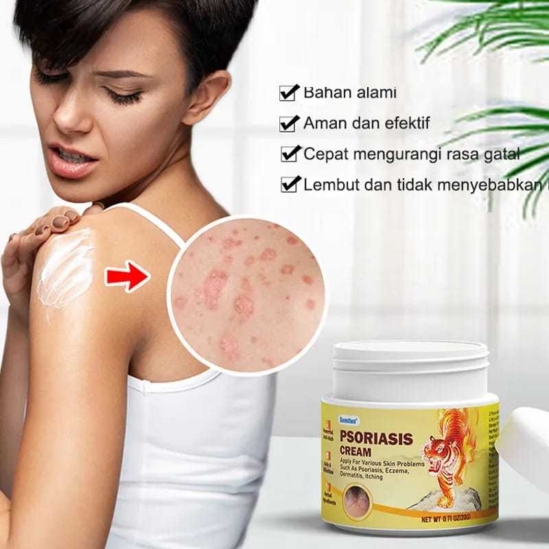 salep jamur kulit  RACIKAN JEPANG salep eksim salep gatal paling ampuh salep gatal 20g Kulit Kepala 