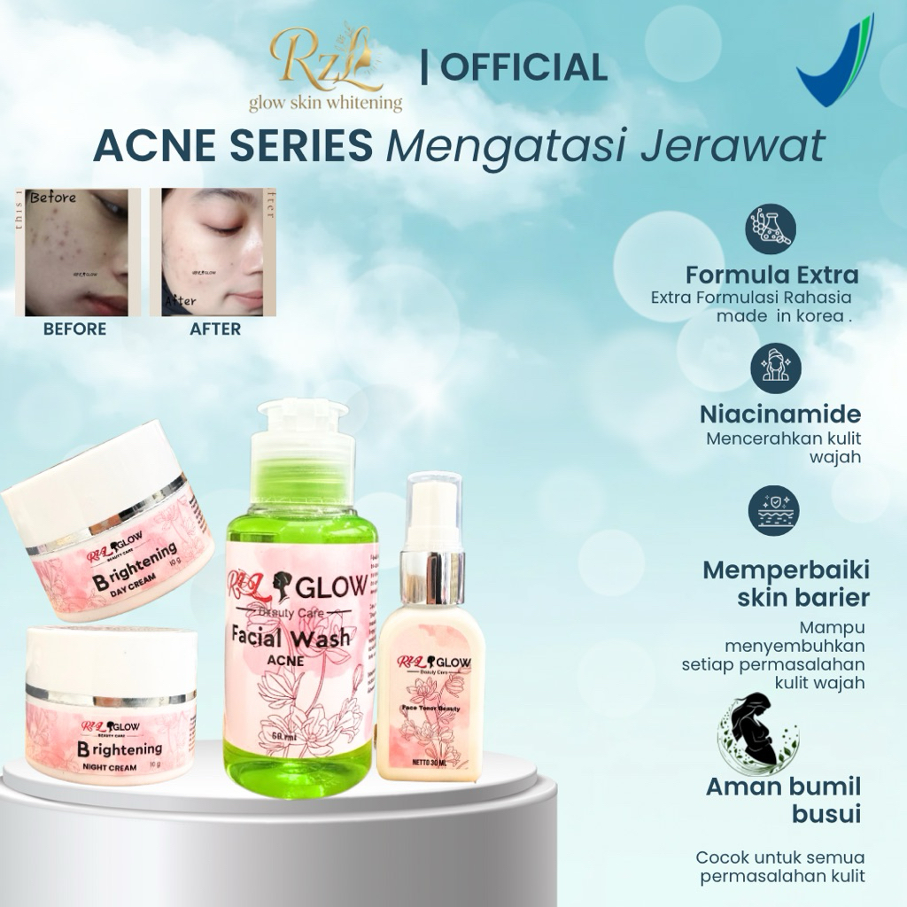 Rzl glow - Rzl skincare - obat jerawat - glowing - acne series