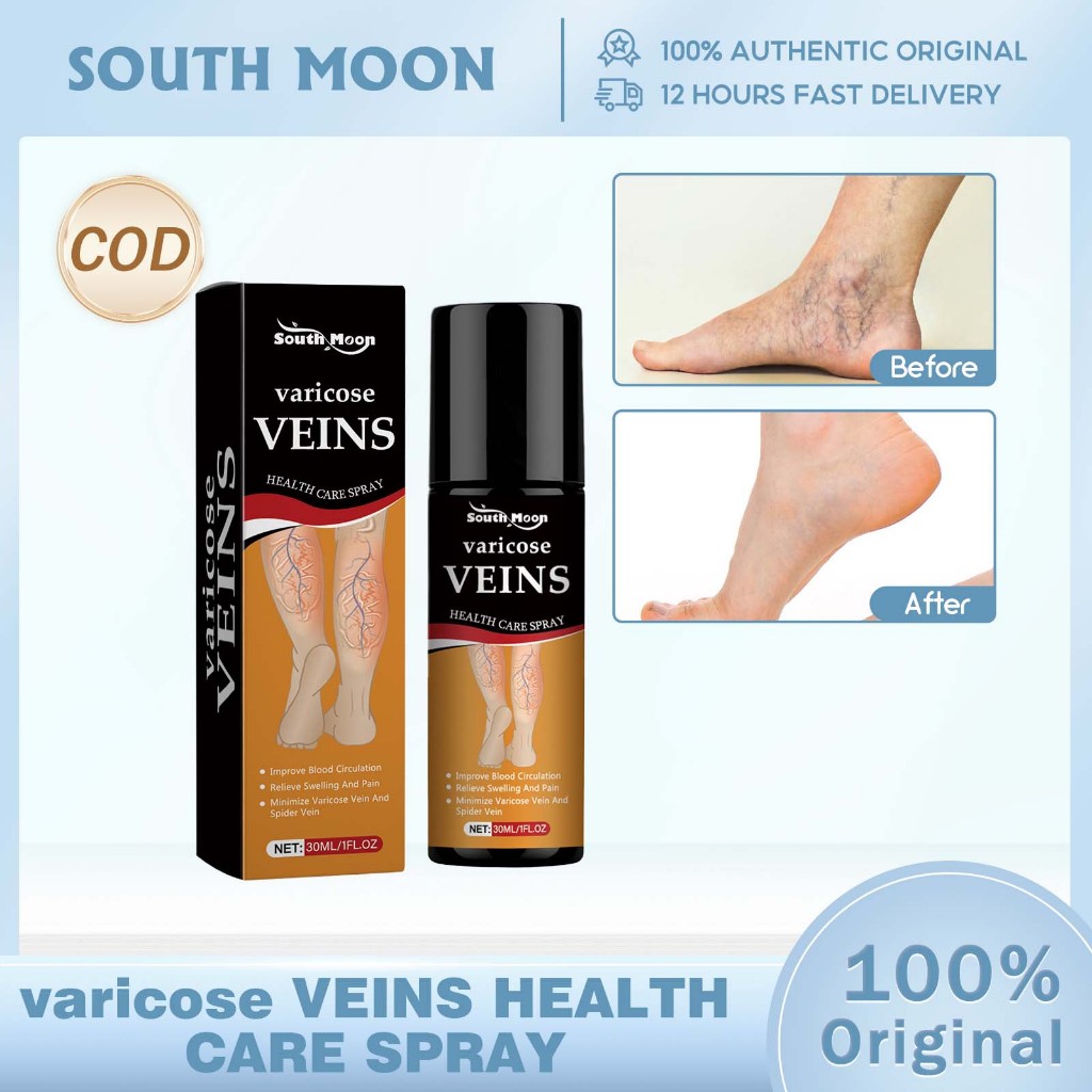 South Moon Semprotan Varises 30ml Meredakan Vasculitis Phlebitis
