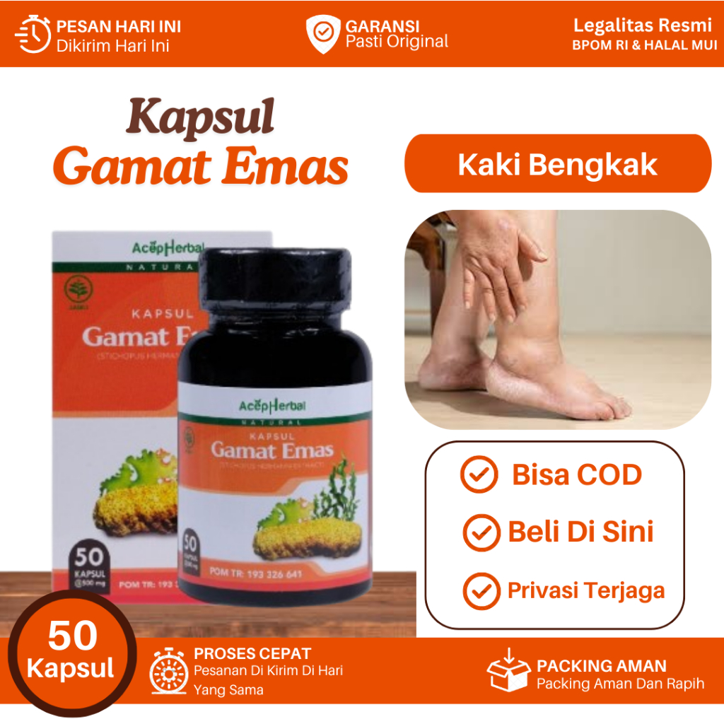 Obat Untuk Kaki Bengkak, Pergelangan Kaki Bengkak, Kaki Bengkak Karena Jatuh, Sakit Kaki Bengkak, Ka