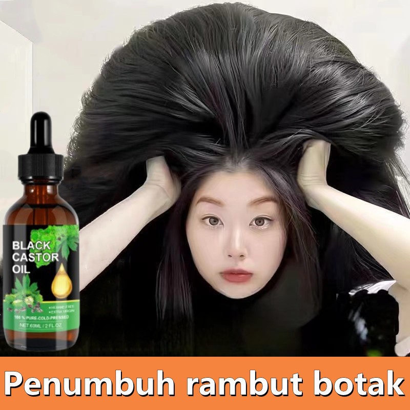 Obat penumbuh rambut Rambut rontok Pelebat rambut anak rambut rontok Penumbuh rambut botak Obat penu