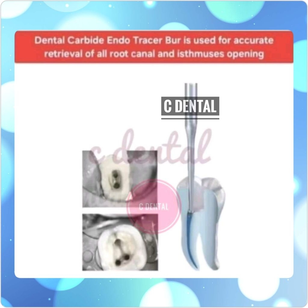 Dental Endo Orifice Tracer Bur Carbide Xtra Long Shank Opening Access Finding Hidden Canal