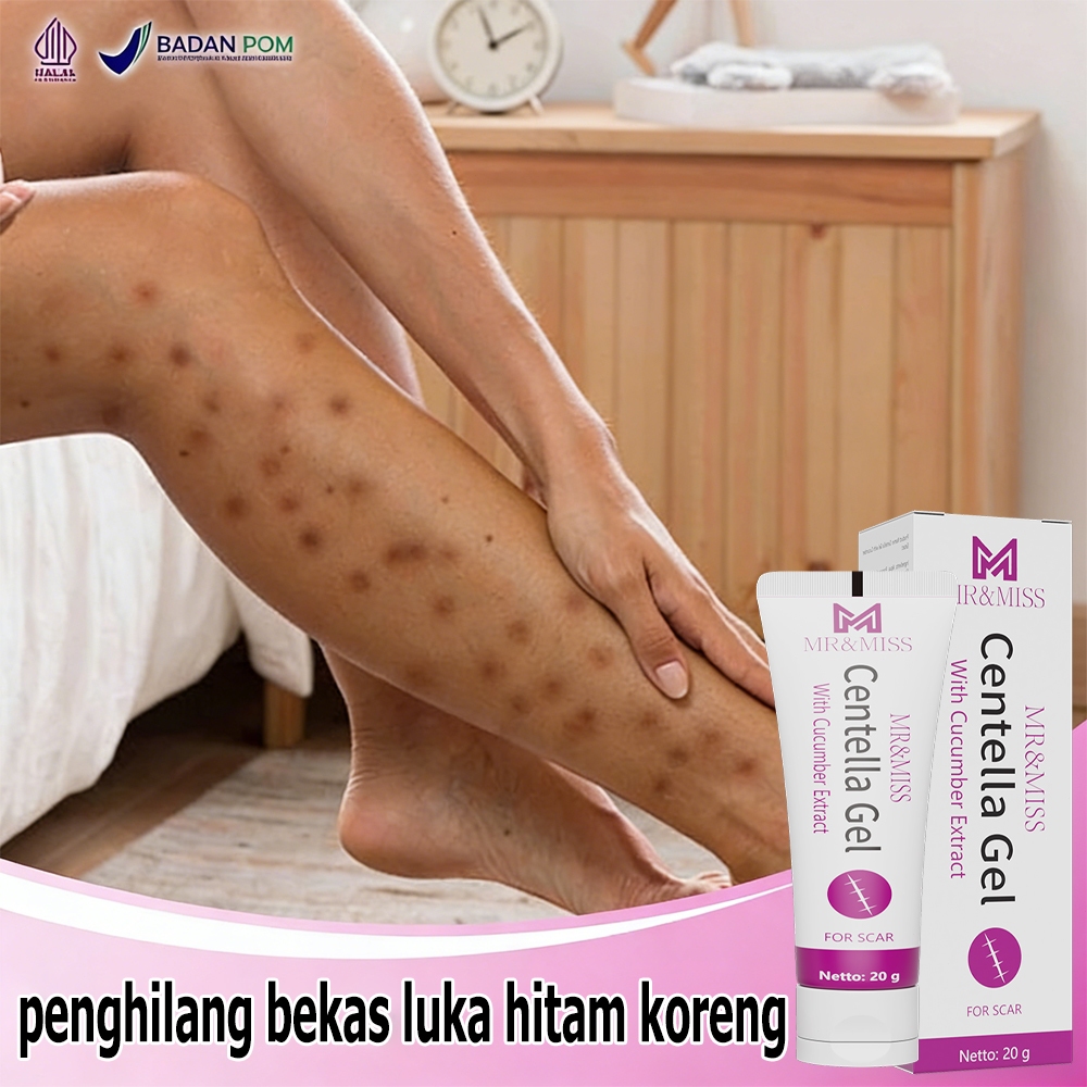 Cream penghilang bekas luka koreng Menghilangkan bekas luka Salep penghilang bekas luka hitam Salep 