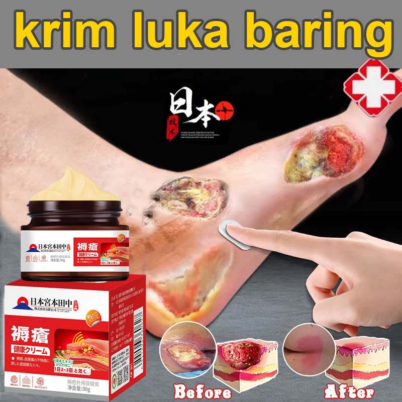 Krim Luka baring/Penyembuhan luka/Luka diabetes/ Krim dekubitus/Mengobati dekubitus 30g