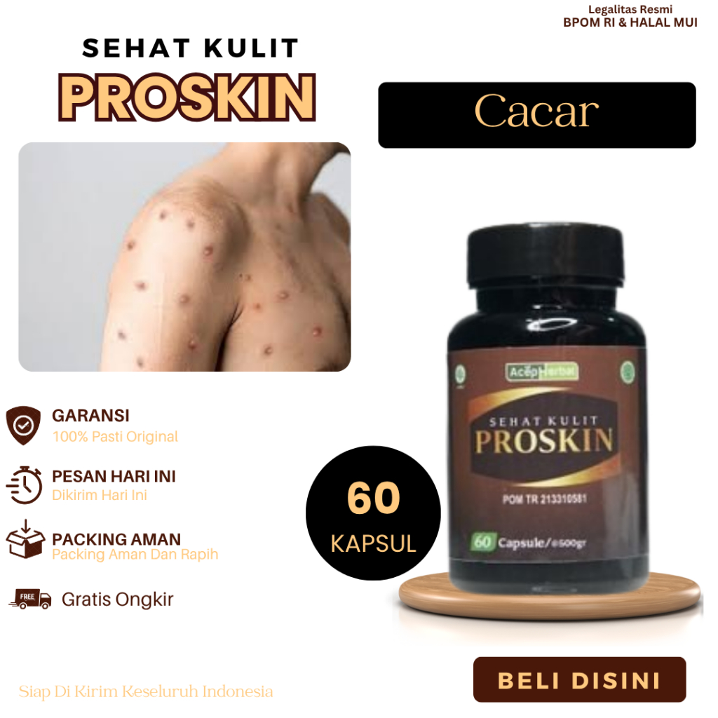 Obat Untuk Cacar, Cacar Bernanah, Cacar Bisul, Cacar Gatal Bintik Api, Penghilang Bekas Cacar Lama -