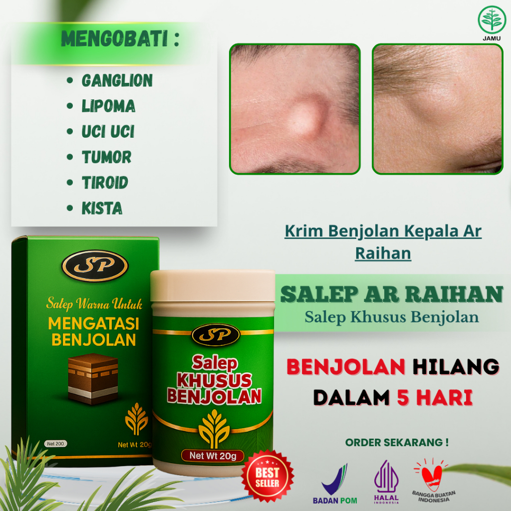 Krim Benjolan Kepala Ar Raihan – Obat Herbal Kista dan Lipoma