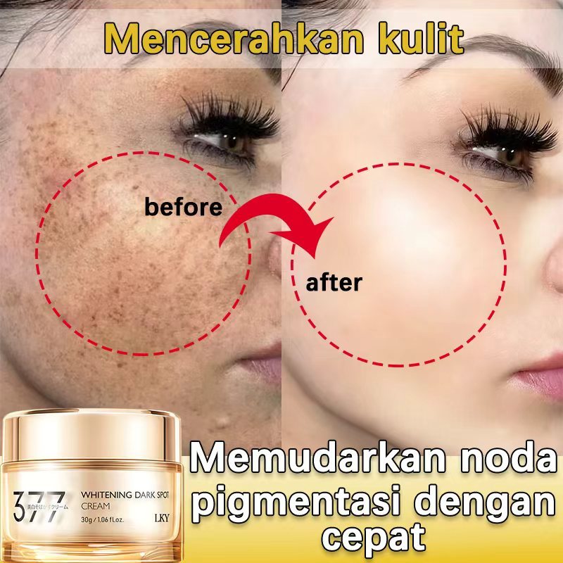 Cream 377 untuk Flek Hitam Membandel Cream Penghilang Flek Hitam 30g Cream Pemutih Wajah untuk Flek 
