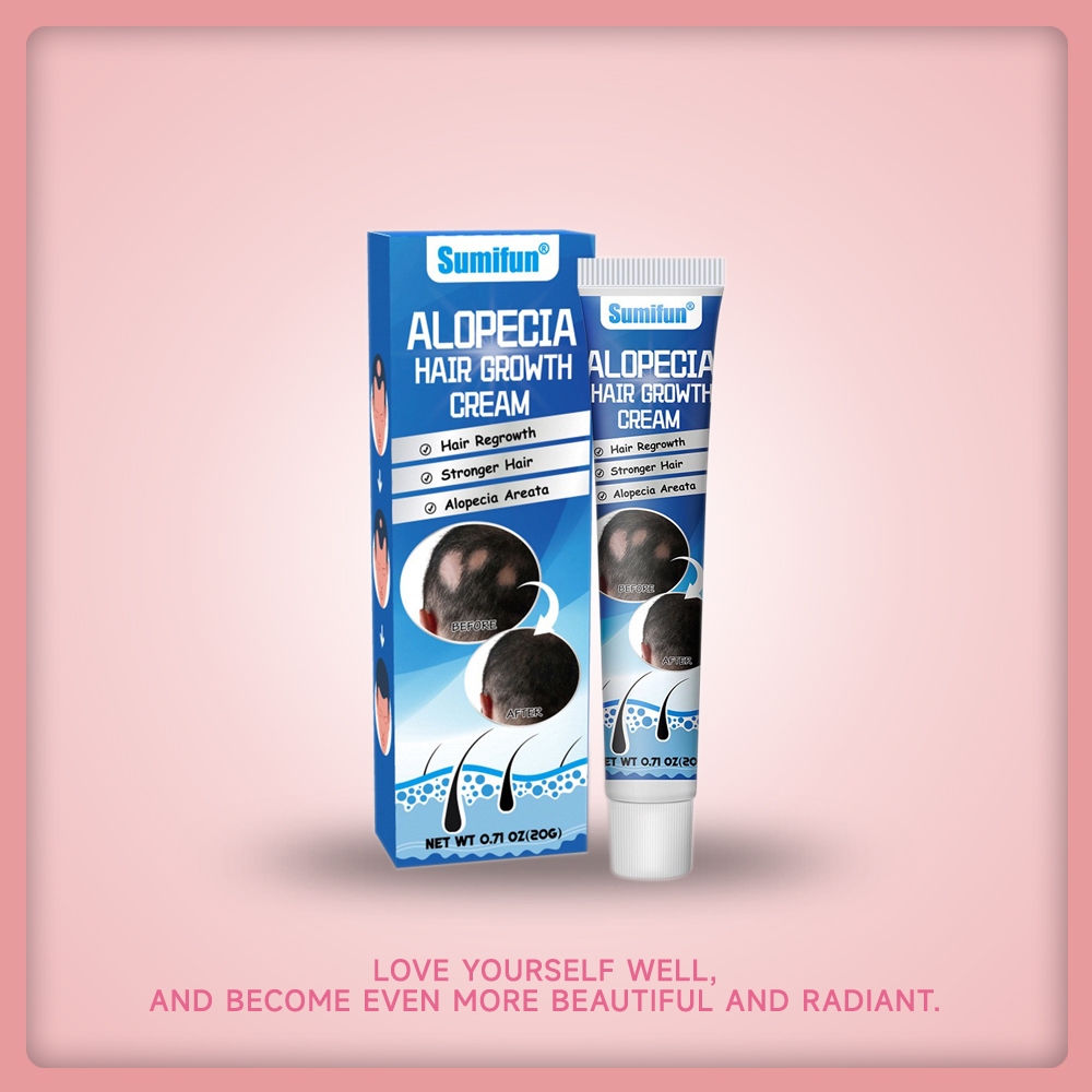 Obat alopecia areata, obat penumbuh rambut cepat