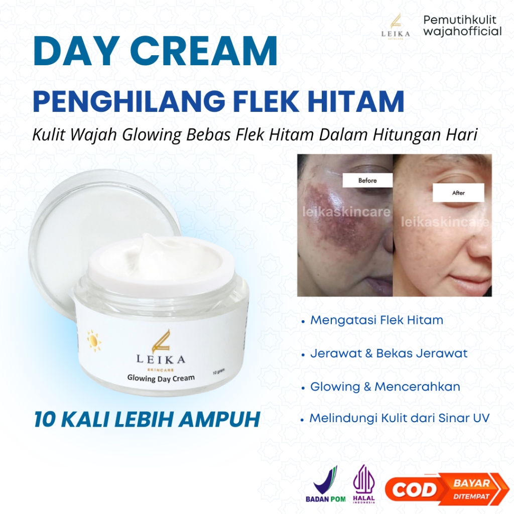 Cream flek hitam membandel krim flek hitam membandel bpom ori cream menghilangkan flek hitam di waja