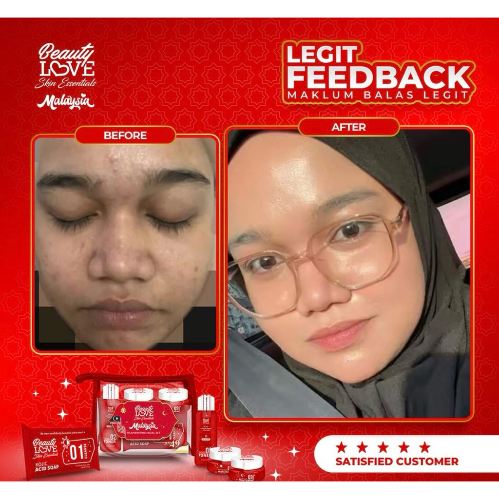 TERMURAH PAKET LENGKAP KRIM CREAM SET BEAUTYLOVE BL MALAYSIA BEAUTY LOVE JAMINAN ORIGINAL ASLI REJUV