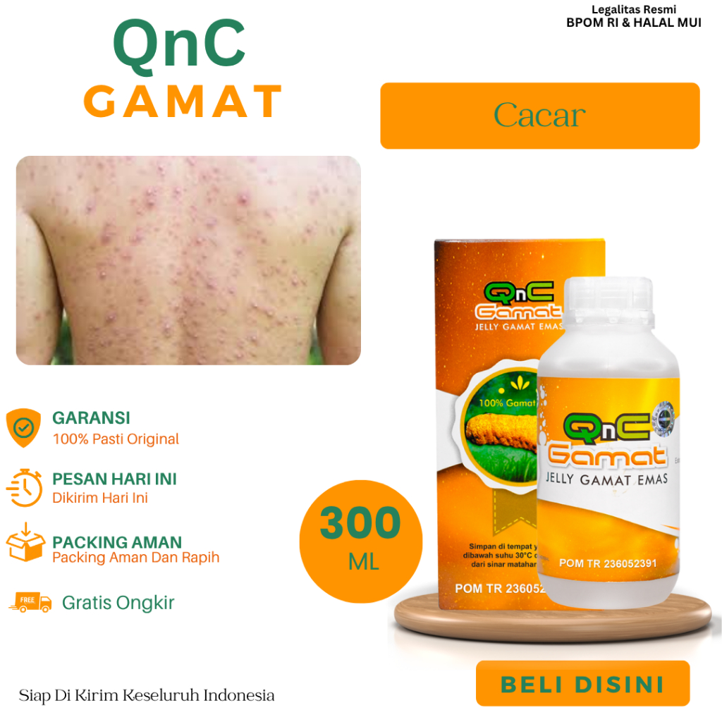 Obat Untuk Cacar, Cacar Bernanah, Api, Monyet, Cacar Gatal Bintik, Cacar Menonjol, Cacar Menghitam, 