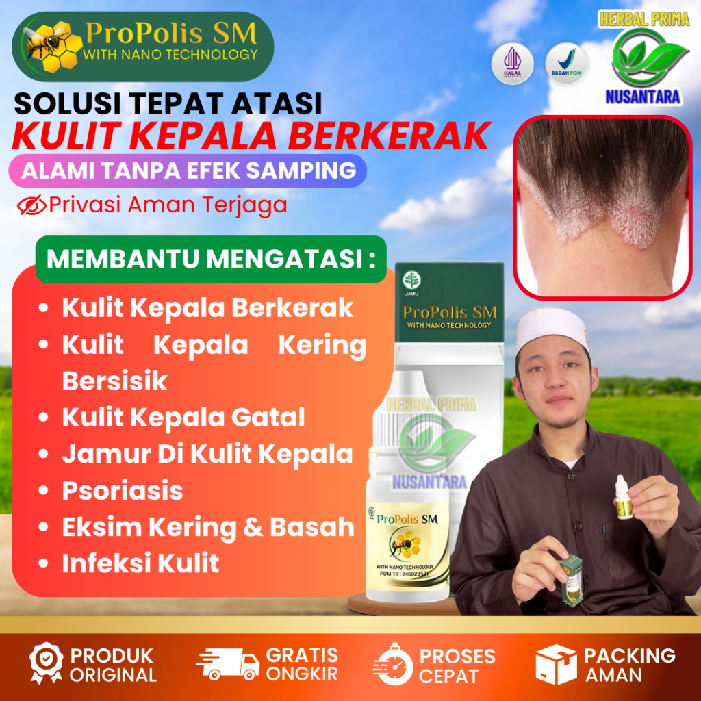 (BISA COD) Obat Oles Tetes Kulit Kepala Berkerak Bersisik Mengelupas, Obat Kulit Kepala Kering, Obat