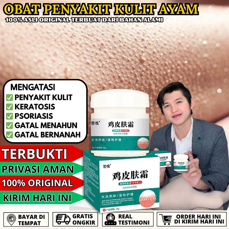 Krim Cream Untuk Mengatasi Kulit Bebintik Seperti Kulit Ayam - Body Lotion Chicken Skin Karena Kerat