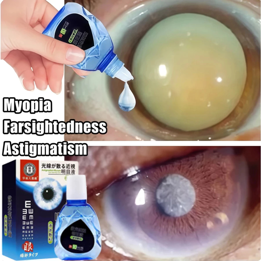 Obat tetes mata Tetes Mata eye 10ml -  Silinder (Astigmatisme), Katarak, Mata Merah, Mata Kering & G