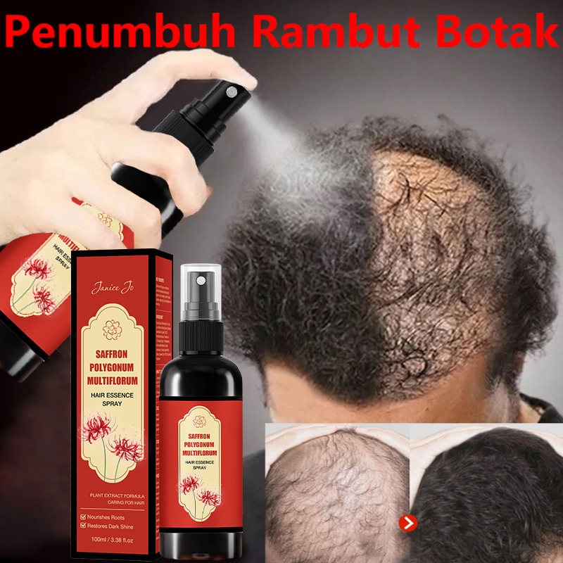 [Ready] Saffron Hair Blackening Spray 400ml Hair Growth Serum Spray Rambut Hitam Penghitam Hitam Ram