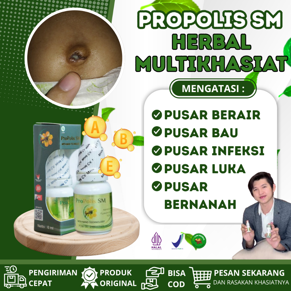 Propolis SM Obat Pusat Berair dan Berbau Tidak Sedap - Pusar Bernanah - Infeksi Di Dalam Pusar - Pro