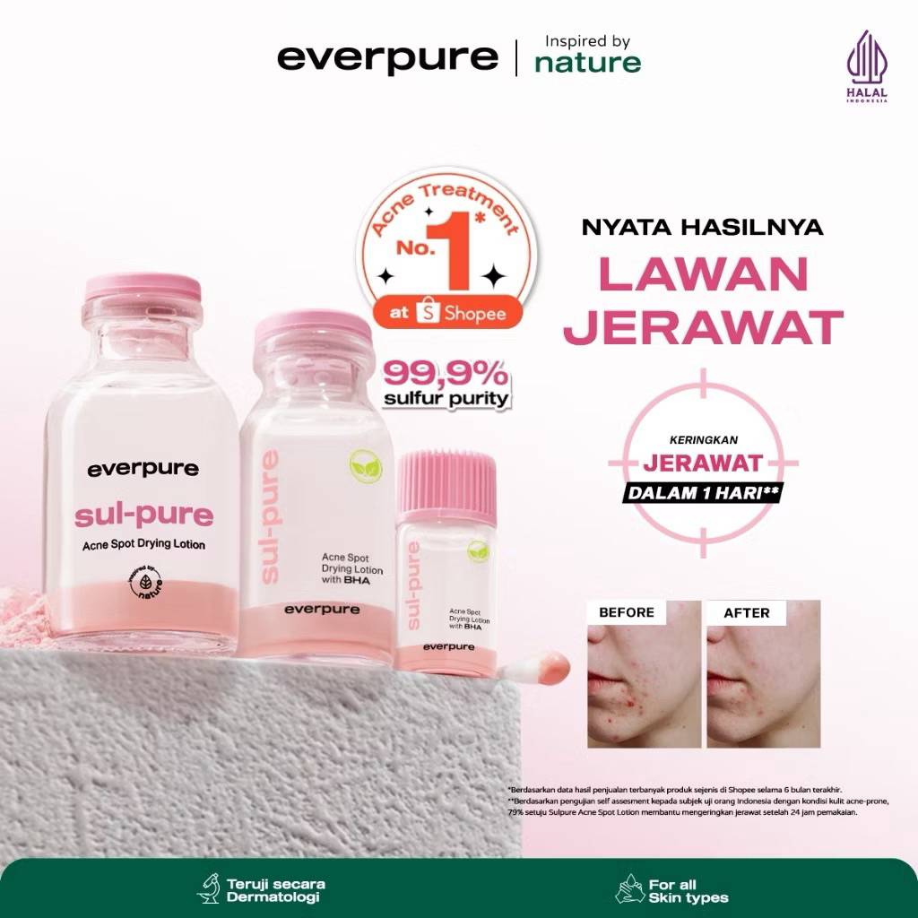 EVERPURE | Everpure Sul-Pure Acne Spot Drying Lotion & Toner