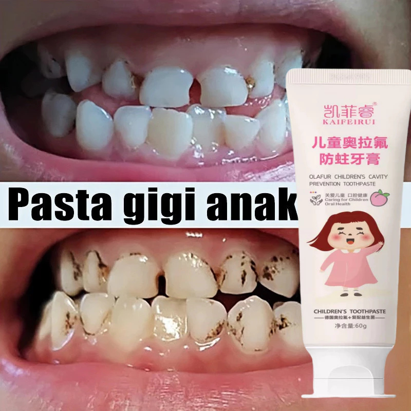 Pasta Gigi Anak Fluoride Rendah Aman Ditelan - Kids Toothpaste Pemutih & Pembersih Karang Gigi 60g U