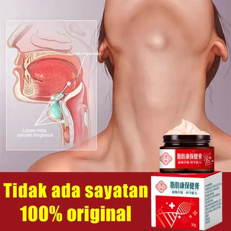 Obat Benjolan Lipoma Krim lipoma OBAT OLES PENGHILANG BENJOLAN LIPOMA 30g Obat Kista Ganglion, Obat 