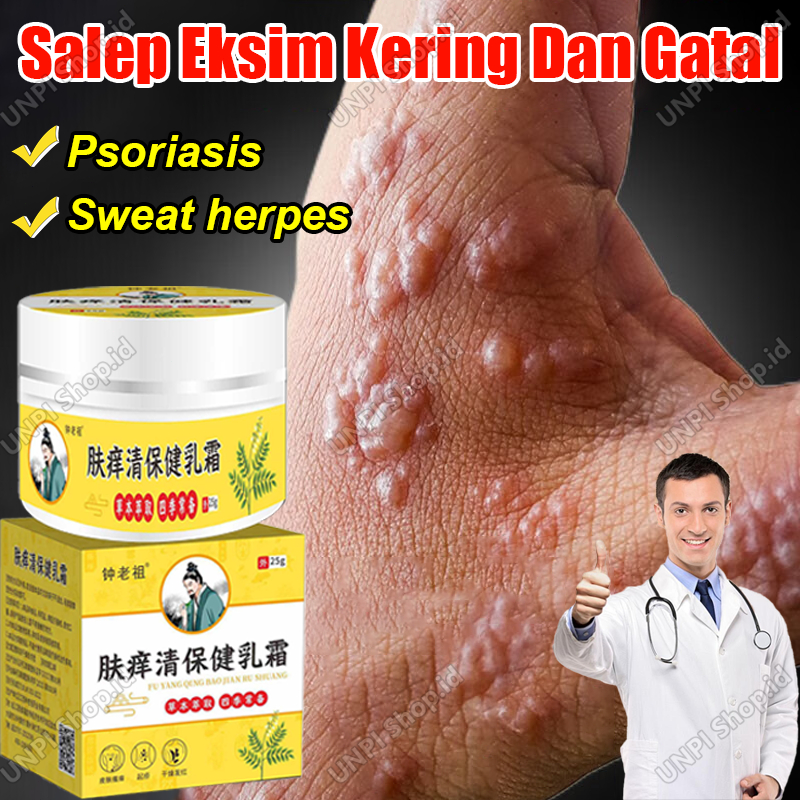 Salep Cina Gatal Paling Ampuh Original Salep Eksim Kering Dan Gatal Obt Gatal Seluruh Badan Obat Gat
