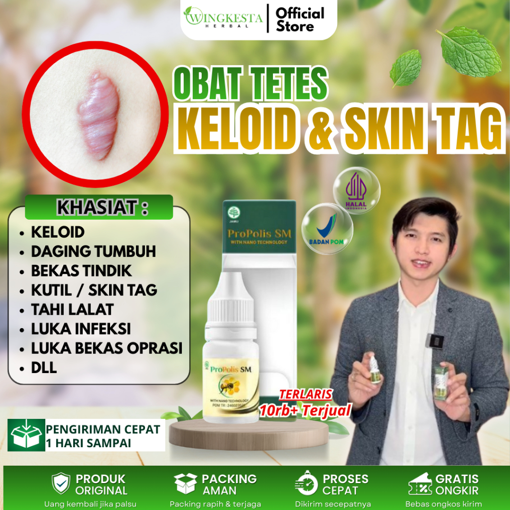 Obat Keloid, Tetes Penghilang Keloid Daging Tumbuh, keloid Luka tindik, Keloid di Telinga, keloid Me