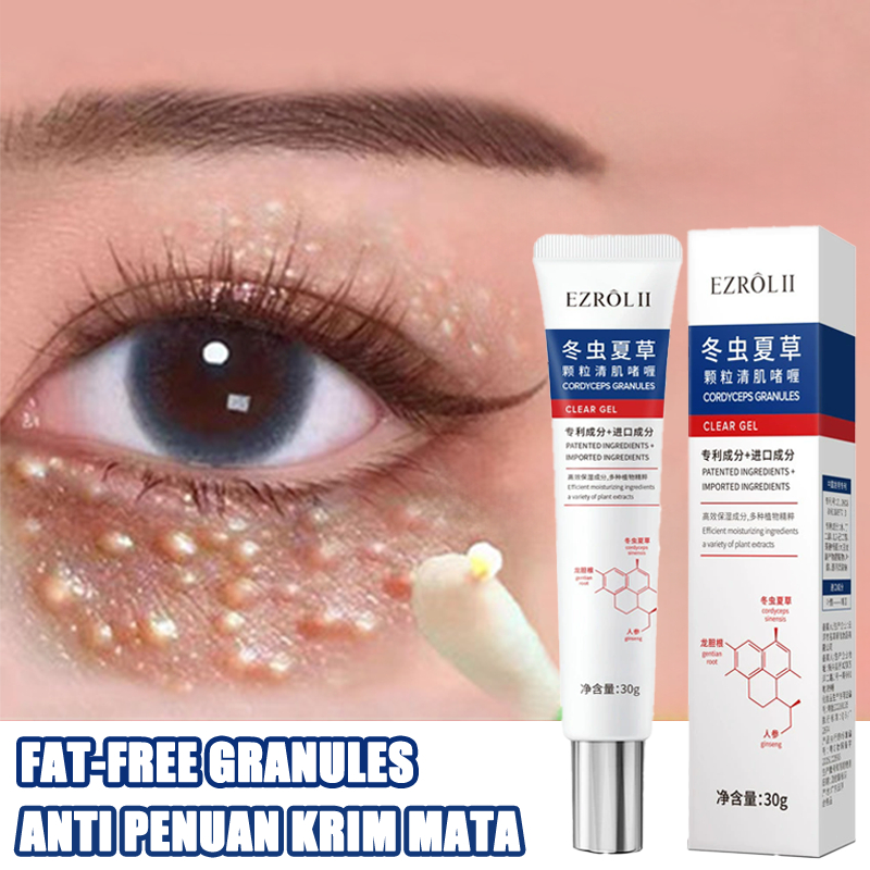 Krim Penghilang Milia 20g Krim Mata Agen Penghilang Milia Obat Milia untuk Bawah Mata Krim Milia Pen