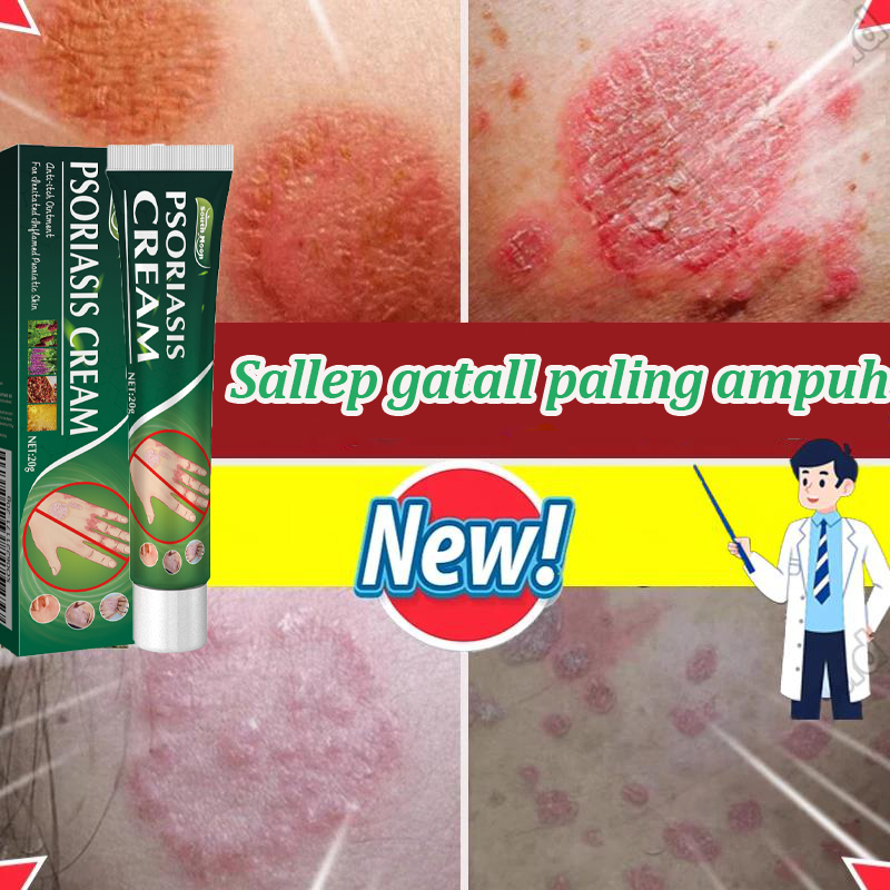Salep Gatal Paling Ampuh Obat Gatal Kulit Paling Ampuh Salep Kulit Gatal Ampuh Psoriasis Eksim Jamur