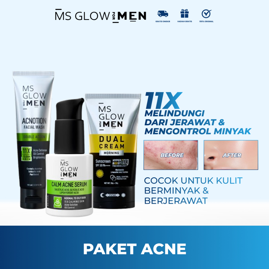 MS GLOW MEN - Paket New Acne Ms Glow for Men Skincare Menghilangkan Jerawat Penghilang Jerawat Pria