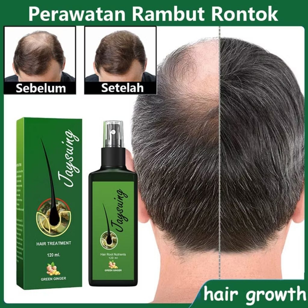 PENUMBUH RAMBUT BOTAK PERAWATAN RAMBUT RONTOK JAYSUING
