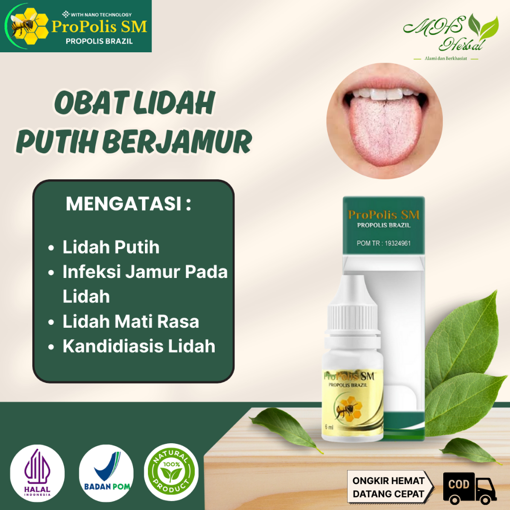Obat Lidah Putih Berjamur, Lidah Mati Rasa, Kandidiasis Lidah - ProPolis SM 6Ml