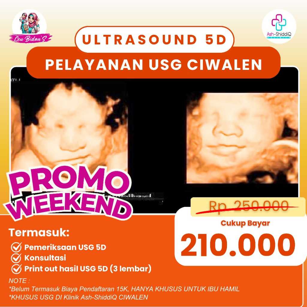 USG 5D PROMO WEEKEND DESEMBER- Print Out hasil USG 5D (3 Lembar), Konsultasi, Pemeriksaan USG 5D