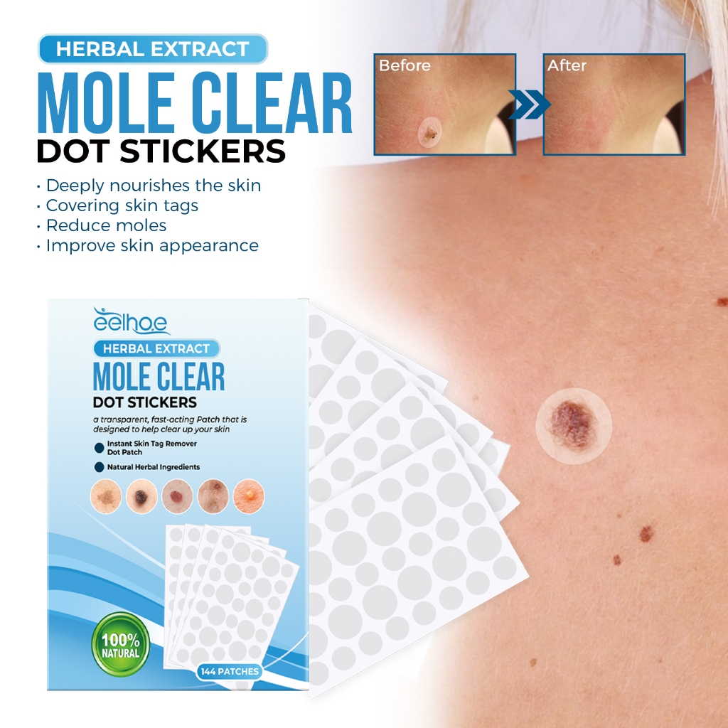 EELHOE Mole Clear Dot Stickers 144pcs Skin Tag Patch Penghilangan Tahi Lalat Dan Kutil Tanpa Rasa Sa