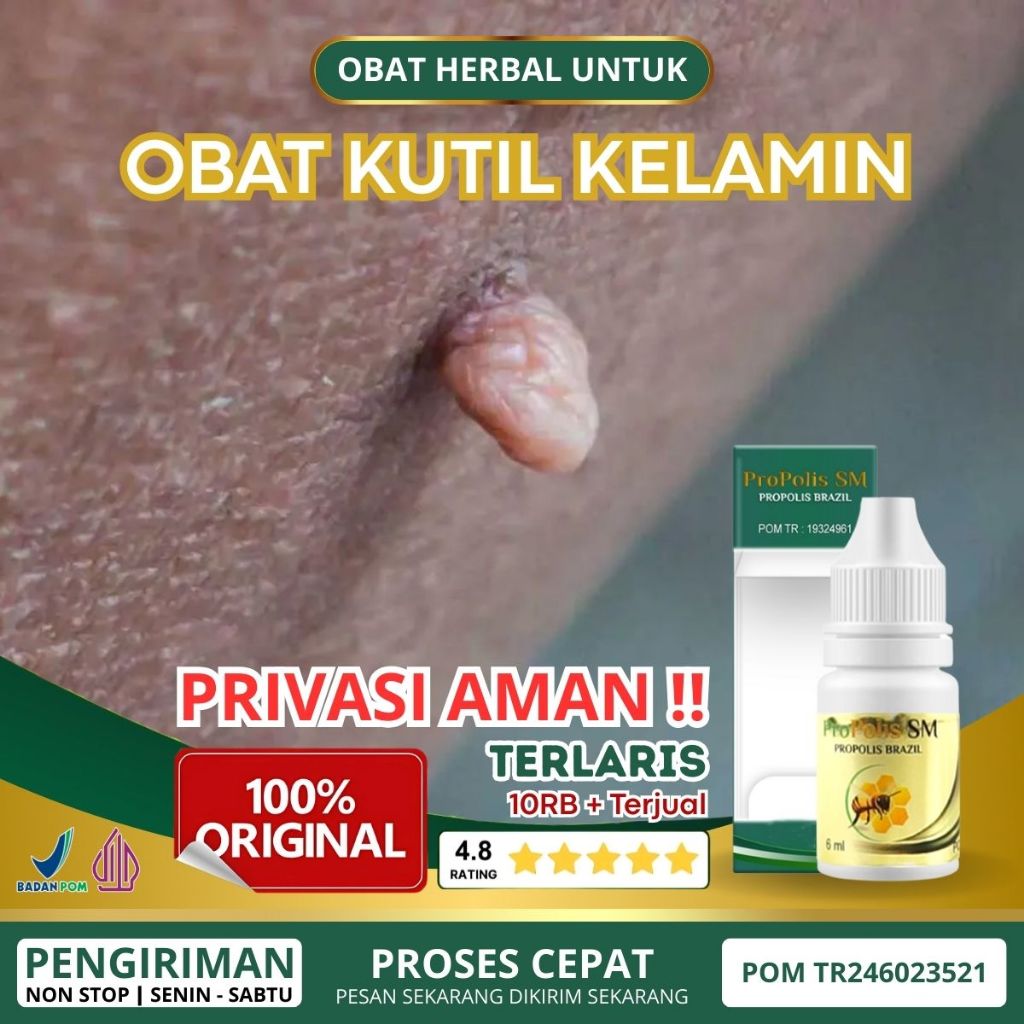 Obat Kutil Kelamin HPV, Kutil Kemaluan, Penghilang Kutil Kelamin Pria Dan Wanita, Perontok Kutil Kel